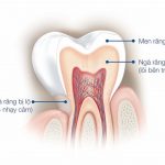 Men răng làm mộ trong 4 thành phần cấu tạo nên răng và nằm ở lớp ngoài cùng