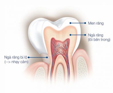 Men răng làm mộ trong 4 thành phần cấu tạo nên răng và nằm ở lớp ngoài cùng
