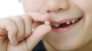 Nhổ răng sữa cho bé khi bé đến độ tuổi thay răng hoặc gặp các vấn đề về răng miệng