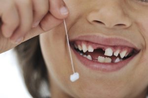 Nhổ răng sữa lung lay cho bé cần đúng thời điểm