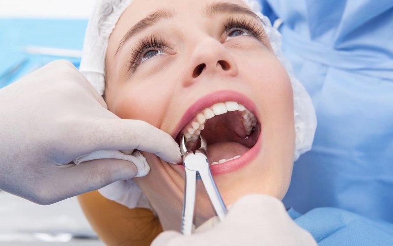 Thời gian phục hình răng giả sau khi nhổ răng phụ thuộc vào nhiều yếu tố