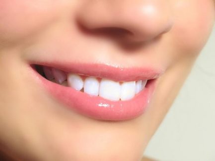 Trồng răng sứ giá bao nhiêu 1 chiếc phụ thuộc nhiều yếu tố