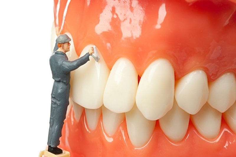 Lấy cao răng tại nhà đơn giản và dễ thực hiện 