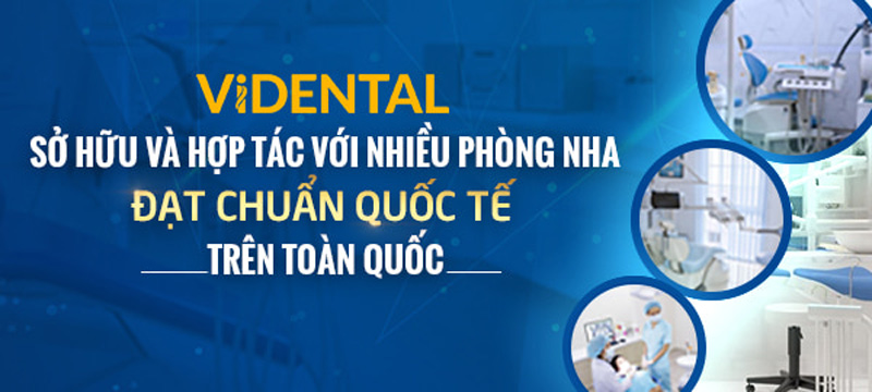 ViDental sở hữu hệ thống phòng khám rộng khắm trên toàn quốc