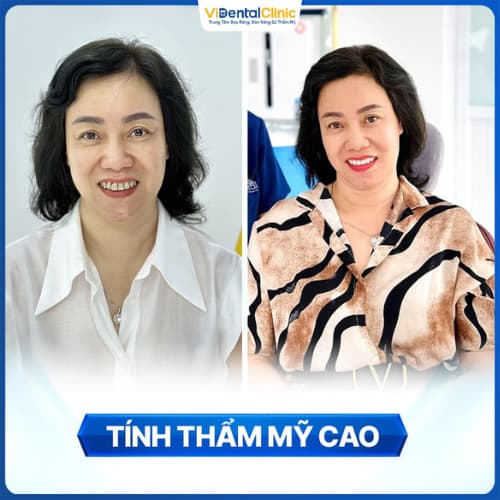 Tạo hình thẩm mỹ nhờ công nghệ bọc sứ hiện đại