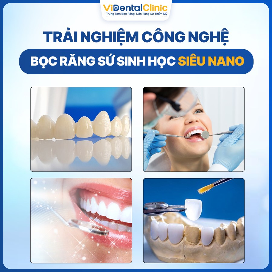 công nghệ bọc răng sứ ViDental Clinic